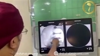 متاستاز سرطان پروستات به مغز