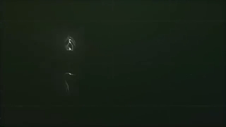 جا انداختن بینی همزمان با جراحی زیبایی بینی