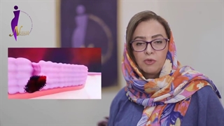 دستکاری زگیل های تناسلی