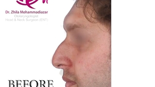 تغییر را در بینی خود احساس کنید