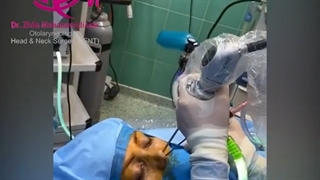 فیلم واقعی اتاق عمل توده پولیپویید وسیع بینی