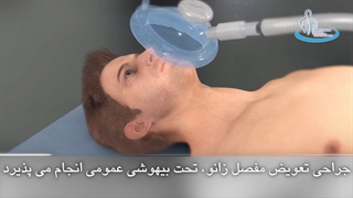 تعویض مفصل زانو | متخصص ارتوپد | دکتر محمد ابراهیم طاهریان