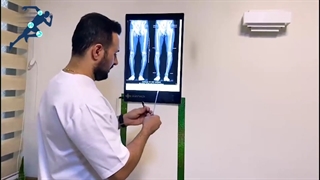 ارتباط علم هندسی و رشته پزشکی ارتوپدی
