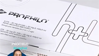 پروفایلو چیست