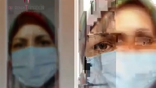 نتیجه عمل زیبایی پلک