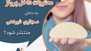 محتویات پروتز سینه داخل مجاری شیردهی می شود؟