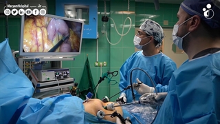 انجام عمل جراحی لاغری برای افراد با BMI بالای 35