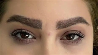 عمل زیبایی در کلینیک آرتین