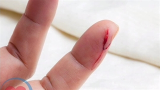 جعبه کمکهای اولیه کاسپین (تا درمان)