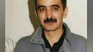 مرحوم فریدون فروغی لیزر صورت