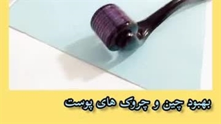 کاهش چین و چروک های پوست صورت۰۹۱۲۰۷۵۰۹۳۲