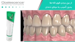 خمیر دندان الترادنت OPALESCENCE WHITENING TOOTH PASTE - آریاتندیس درمان پارسه