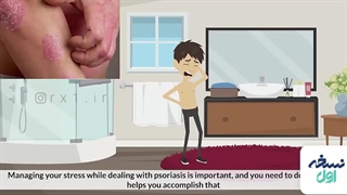 درمان پسوریازیس - داروخانه آنلاین نسخه اول - داروخانه اینترنتی نسخه اول