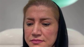 با جراحی پلک، ظاهری سرحال‌تر و جذاب‌تر داشته باشید.