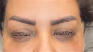 بهترین دکتر لیفت با نخ در اصفهان/ جناب مگ