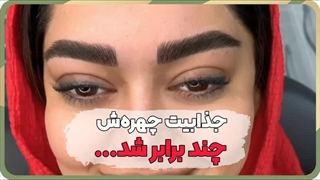 بهترین مرکز فیبروز ابرو در سیروس