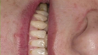 دکتر سید رضا خسروانی جراحی فک