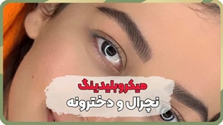 بهترین مرکز فیبروز ابرو در شهرک رسالت