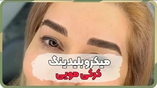 بهترین مرکز فیبروز ابرو در نادری