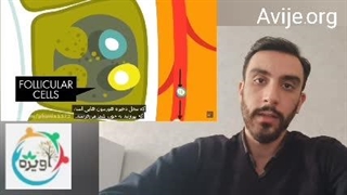 معافیت پزشکی سربازی پر کاری تیروئید