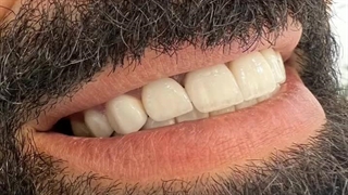دکتر بهاره حسینی محور برداشتن توده