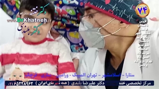 هزینه ختنه تهران بهترین قیمت ختنه