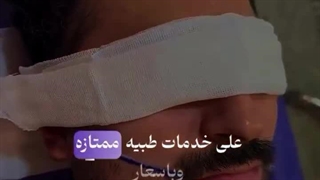 زراعة الشعر فی إیران: وجهتکم للعلاج والثقة بأسعار ممیزة