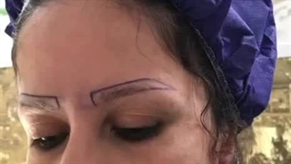 کاشت ابرو در کلینیک آوینا